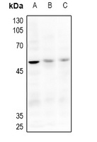 ACVR2A Rabbit Polyclonal Antibody