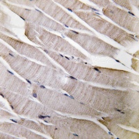 Defensin alpha 3 Rabbit Polyclonal Antibody