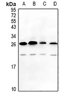 MAGEA5 Rabbit Polyclonal Antibody