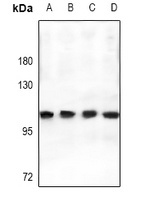 MMP9 Rabbit Polyclonal Antibody