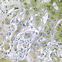 ACOT12 Rabbit Polyclonal Antibody