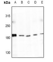 Collagen 4 alpha 4 Rabbit Polyclonal Antibody