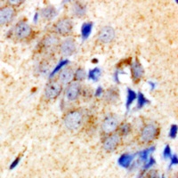 Collagen 4 alpha 4 Rabbit Polyclonal Antibody