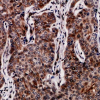 Collagen 5 alpha 2 Rabbit Polyclonal Antibody