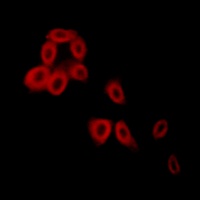 Collagen 5 alpha 2 Rabbit Polyclonal Antibody
