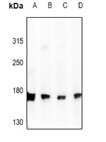 DLC1 Rabbit Polyclonal Antibody