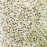 DLC1 Rabbit Polyclonal Antibody