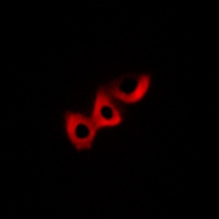 DLC1 Rabbit Polyclonal Antibody
