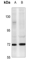 TNFAIP2 Rabbit Polyclonal Antibody