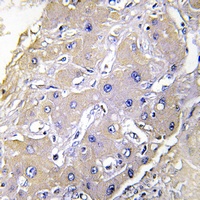 TNFAIP2 Rabbit Polyclonal Antibody