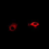 TNFAIP2 Rabbit Polyclonal Antibody