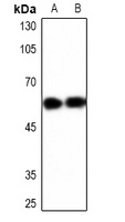 YBX1 Rabbit Polyclonal Antibody