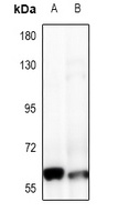 FRS2 Rabbit Polyclonal Antibody