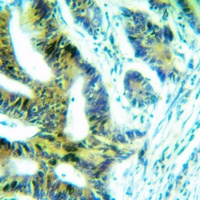FRS2 Rabbit Polyclonal Antibody
