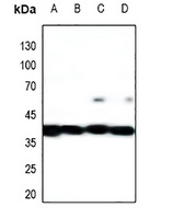 MKK1/2 Rabbit Polyclonal Antibody