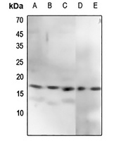 CENPA (Phospho-S7) Rabbit Polyclonal Antibody