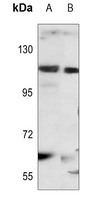 STAT2 Rabbit Polyclonal Antibody