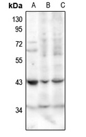 SerpinB1 Rabbit Polyclonal Antibody