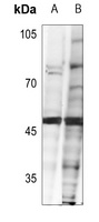 FOXH1 Rabbit Polyclonal Antibody