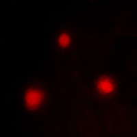 FOXH1 Rabbit Polyclonal Antibody