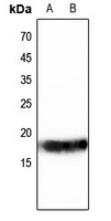 Histone H3 Rabbit Polyclonal Antibody