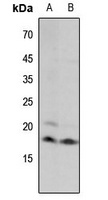 Histone H3 (MonoMethyl-K18) Rabbit Polyclonal Antibody