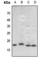 Histone H3 (TriMethyl-K79) Rabbit Polyclonal Antibody
