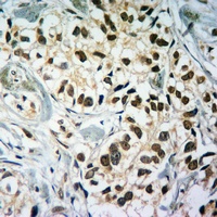 Histone H3 (TriMethyl-K79) Rabbit Polyclonal Antibody