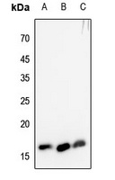 Histone H3 (TriMethyl-K4) Rabbit Polyclonal Antibody