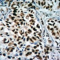 Histone H3 (TriMethyl-K4) Rabbit Polyclonal Antibody
