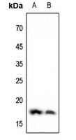 Histone H3 (DiMethyl-K4) Rabbit Polyclonal Antibody