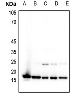 Histone H3 (MonoMethyl-K4) Rabbit Polyclonal Antibody