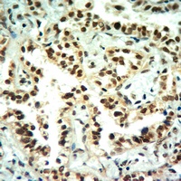 Histone H3 (MonoMethyl-K4) Rabbit Polyclonal Antibody