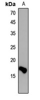 Histone H3 (DiMethyl-K36) Rabbit Polyclonal Antibody