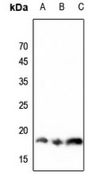 Histone H3 (MonoMethyl-K36) Rabbit Polyclonal Antibody