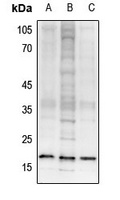 Histone H3 (TriMethyl-K27) Rabbit Polyclonal Antibody
