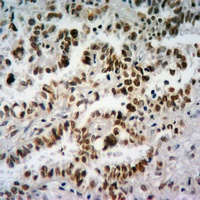 Histone H3 (TriMethyl-K27) Rabbit Polyclonal Antibody