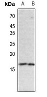 Histone H3 (Butyryl-K18) Rabbit Polyclonal Antibody