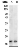 Histone H3 (Acetyl-K36) Rabbit Polyclonal Antibody