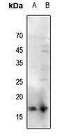 Histone H3 (Acetyl-K56) Rabbit Polyclonal Antibody