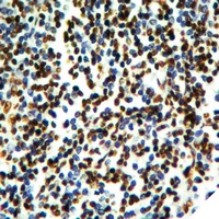 Histone H2B (Acetyl-K20) Rabbit Polyclonal Antibody