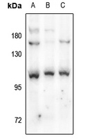 MMP9 Rabbit Polyclonal Antibody