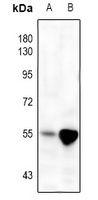 MMP3 Rabbit Polyclonal Antibody