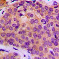 MMP3 Rabbit Polyclonal Antibody