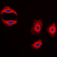 MMP3 Rabbit Polyclonal Antibody