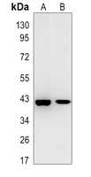 G6PC1 Rabbit Polyclonal Antibody