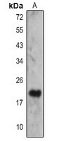 IL-23 alpha Rabbit Polyclonal Antibody