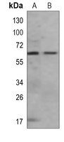 IRSp53 Mouse Monoclonal Antibody