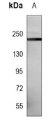 NOTCH3 Mouse Monoclonal Antibody