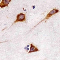 FAM120A Mouse Monoclonal Antibody